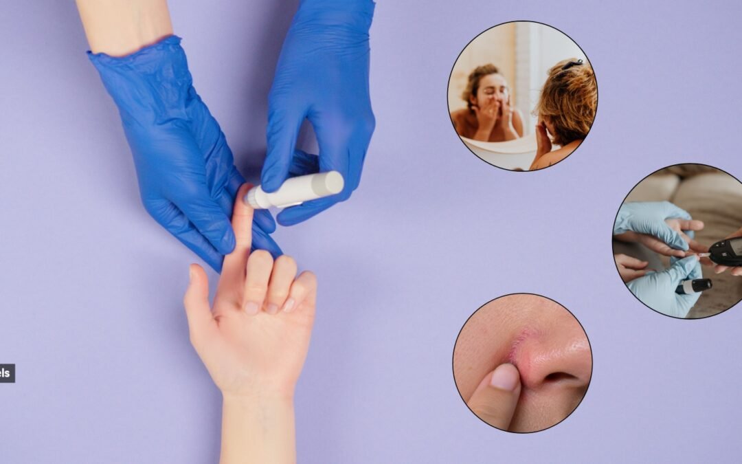 Can you really tell if someone has high blood sugar by looking at their face?